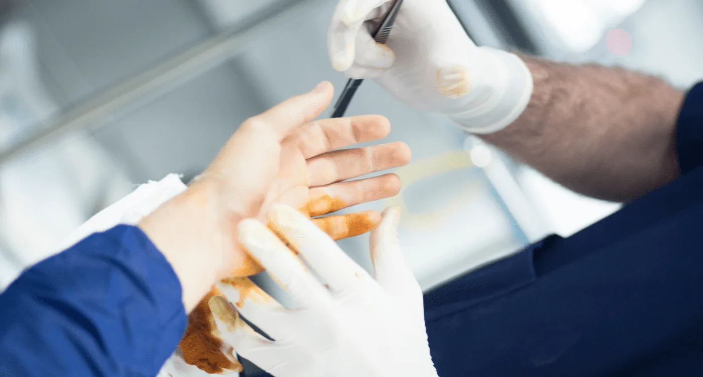 Desgaste articular en Villahermosa: causas y cómo afecta tus articulaciones