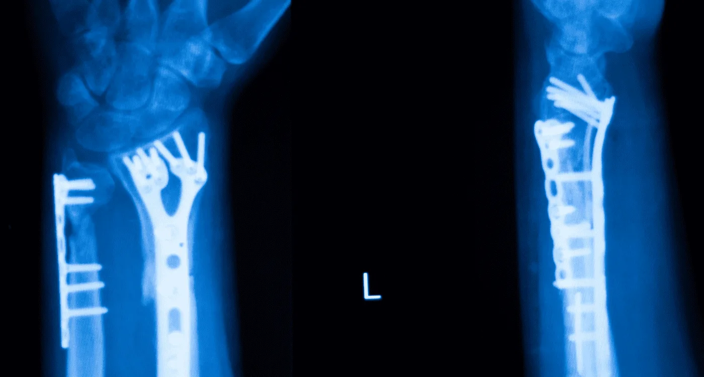 ¿Qué especialista trata el dolor de cadera?