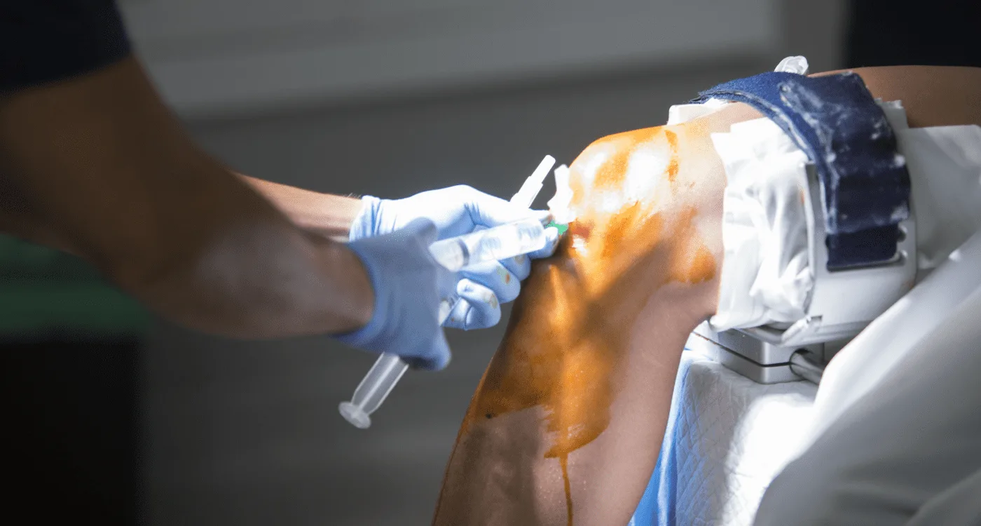 ¿Qué especialista trata las fracturas?