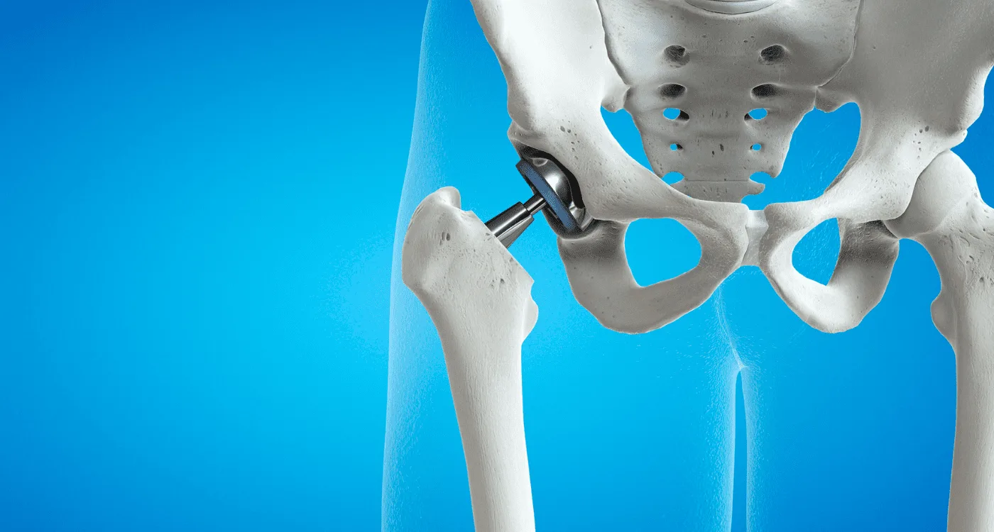 ¿Sufres una lesión de menisco en Villahermosa?