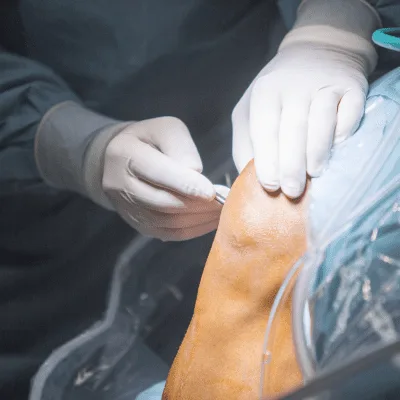 ¿Qué especialista trata la tendinitis?